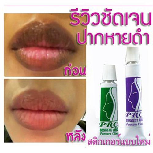 ครีมแก้ปากดำ ครีมปากชมพู ลิปแก้ปากดำ เดอร์มาคลีนิค 2 หลอด(สีม่วง+ เขียว)