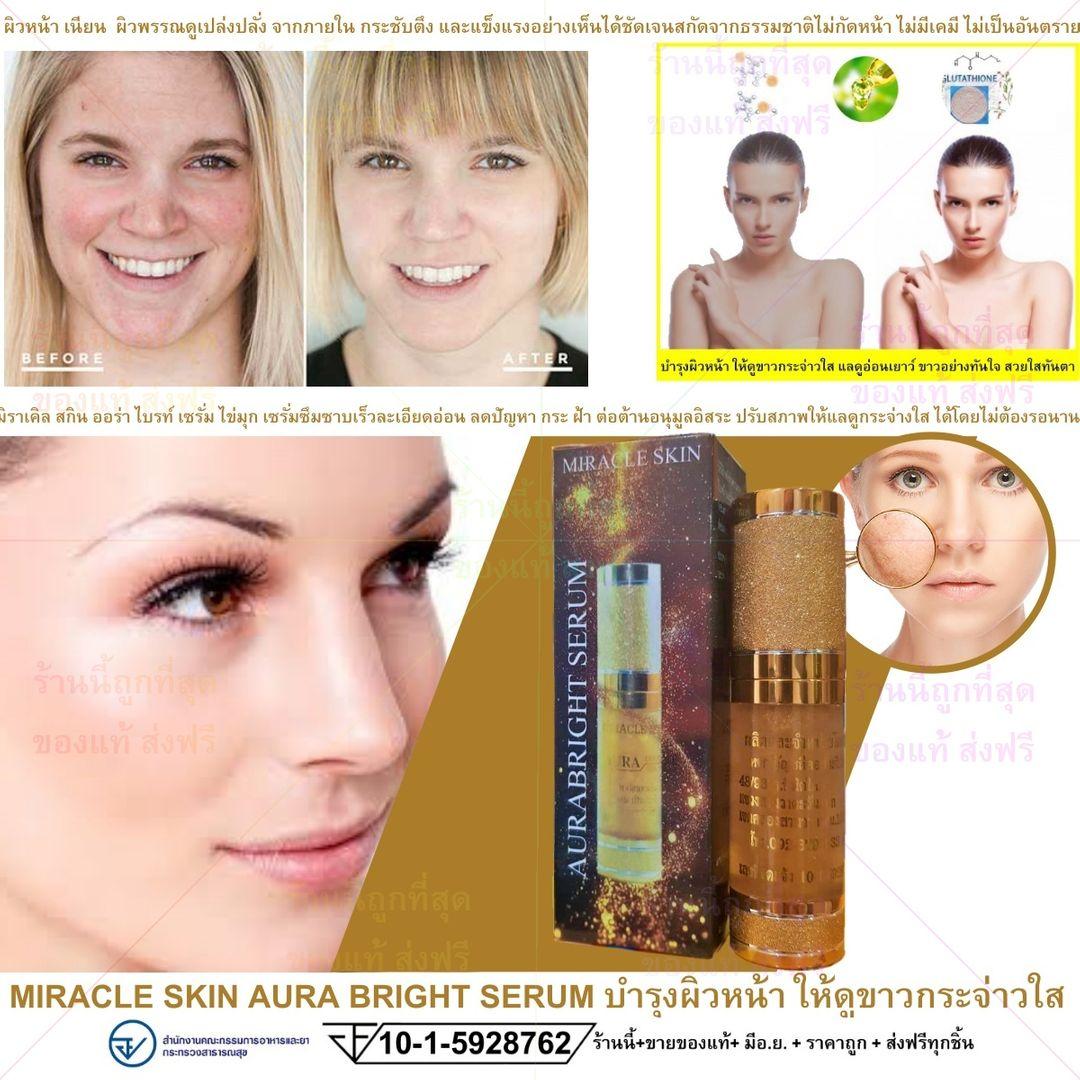รีวิว MIRACLE SKIN AURA BRIGHT SERUM บำรุงผิวหน้า ให้ดูขาวกระจ่าวใส แลดูอ่อนเยาว์ ขาวอย่างทันใจ สวยใสทันตา มิราเคิล สกิน ออร่า ไบรท์ เซรั่ม ไข่มุก เซรั่มซึมซาบเร็วลดปัญหา กระ ฝ้า ต่อต้านอนุมูลอิสระ ปรับสภาพให้แลดูกระจ่างใส ขนาด 15 กรัม รีวิว MIRACLE SKIN AURA BRIGHT SERUM บำรุงผิวหน้า ให้ดูขาวกระจ่าวใส แลดูอ่อนเยาว์ ขาวอย่างทันใจ สวยใสทันตา มิราเคิล สกิน ออร่า ไบรท์ เซรั่ม ไข่มุก เซรั่มซึมซาบเร็วลดปัญหา กระ ฝ้า ต่อต้านอนุมูลอิสระ ปรับสภาพให้แลดูกระจ่างใส ขนาด 15 กรัม