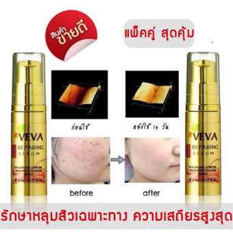 VEVA Repairing Serum เซรั่มเรียกเนื้อหลุมสิว หน้าหลุมรอยสิว รอยดำ รอยแดง เติมเต็มหลุมสิว 10 ml.(แพ็ค 2 ชิ้น) VEVA Repairing Serum เซรั่มเรียกเนื้อหลุมสิว หน้าหลุมรอยสิว รอยดำ รอยแดง เติมเต็มหลุมสิว 10 ml.(แพ็ค 2 ชิ้น)