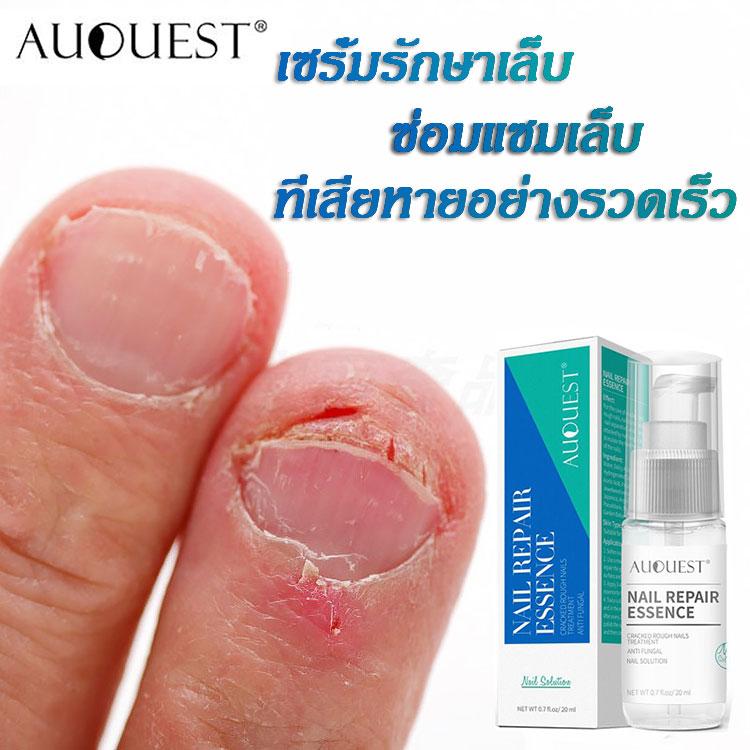 AuQuest เซรั่มรักษาเล็บ เซรั่มดูแลเล็บ เซรั่มรักษาเล็บเสีย  Nail care 20ml กำจัดเชื้อราที่เล็บ รักษาเล็บขบ เล็บหนา เล็บเปราะ