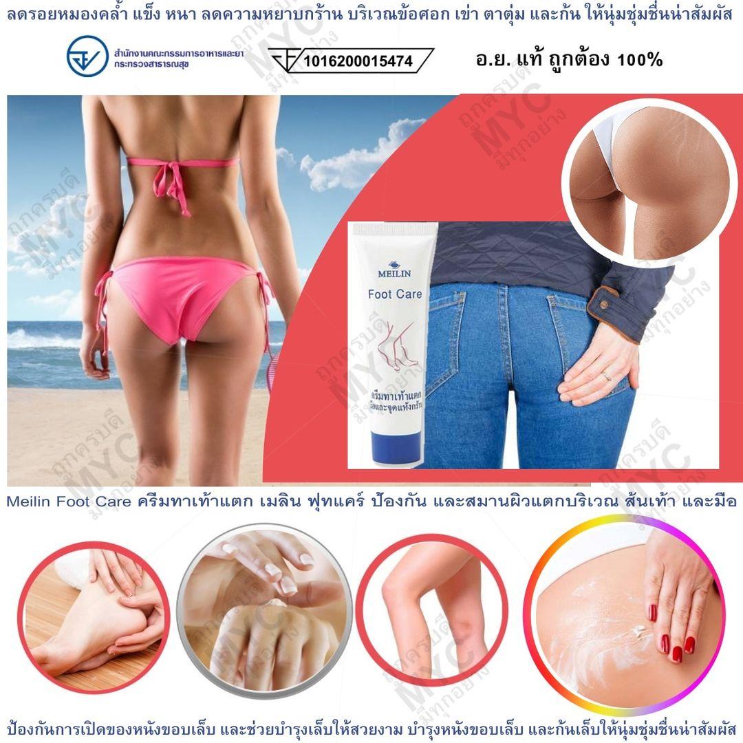 Meilin Foot Care ครีมทาเท้าแตก เมลิน ฟุทแคร์ ป้องกัน และสมานผิวแตกบริเวณ ส้นเท้า และมือ ลดรอยหมองคล้ำ แข็ง หนา ลดความหยาบกร้าน บริเวณข้อศอก เข่า ตาตุ่ม บำรุงหนังขอบเล็บ และก้นให้นุ่มชุ่มชื่นน่าสัมผัส 45g