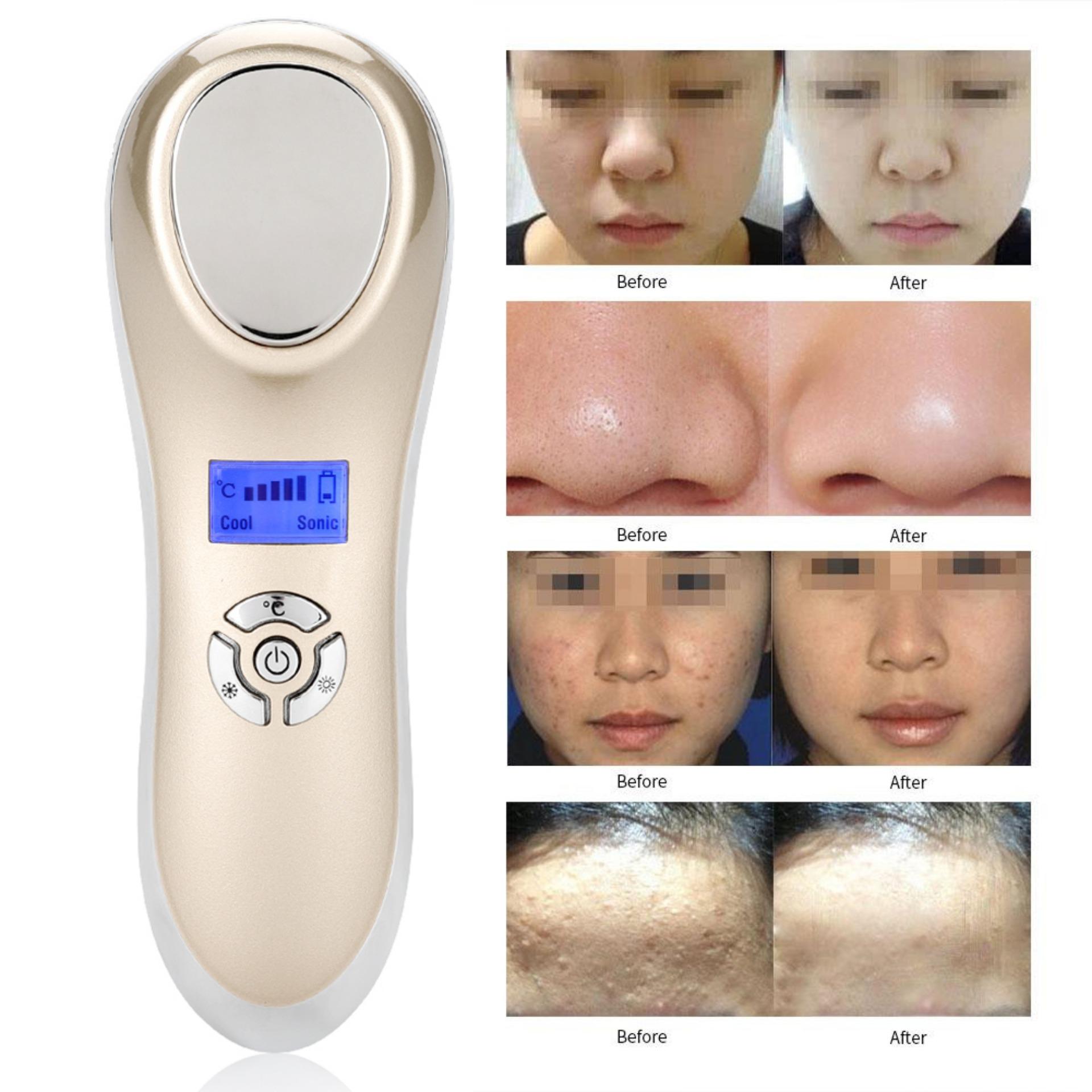 USB Charging Ultrasonic Hot Cold Skin Tighten Device Face Lifting Beauty Machine Golden USB Charging Ultrasonic Hot Cold Skin Tighten Device Face Lifting Beauty Machine Golden