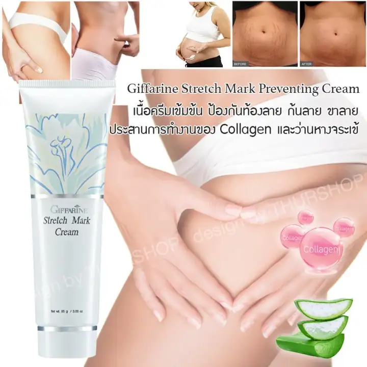 giffarine stretch mark cream