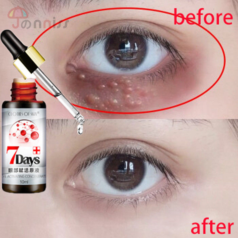 ที่มาร์คใต้ตา serum อายครีม Eye essence ยกกระชับต่อต้านริ้วรอยลดริ้วรอยกำจัดถุงใต้ตาและอนุภาคไขมัน