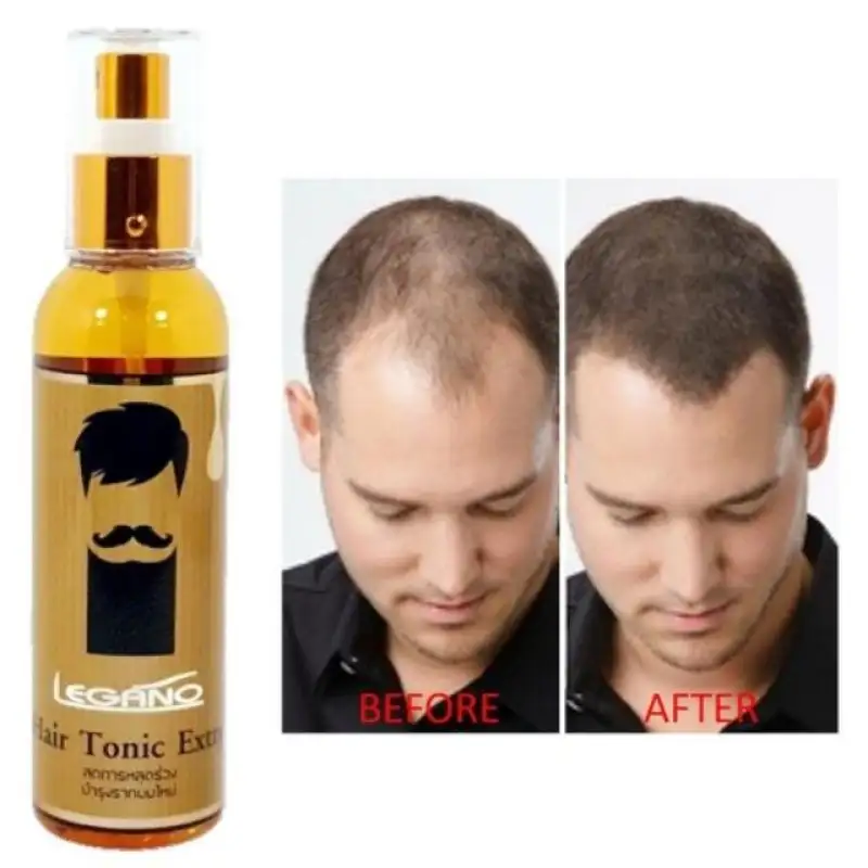 ภาพสินค้าLegano Hair Tonic Extra สเปร์ยปลูกผม หนวด คิ้ว ลีกาโน่ 120ml. จากร้าน The RichShop 888 บน Lazada ภาพที่ 1