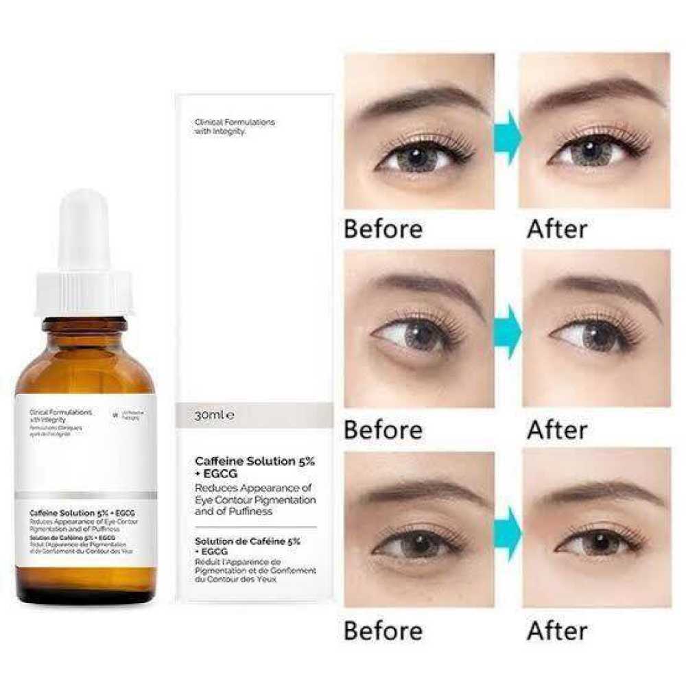 The Ordinary 5 caffeine solutionEGCG 30Ml eye care Serum to reduce
