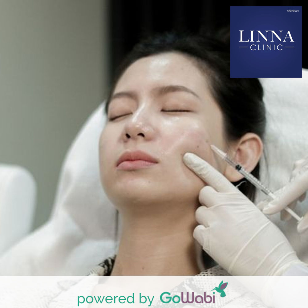 LINNA Clinic - Botoxยกกระชับใบหน้า(40 Units) Botox (40 Units)
