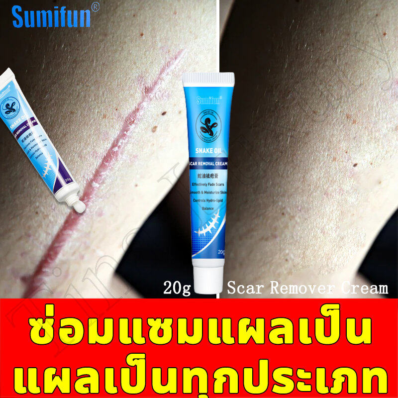 ปรับปรุงรอยแผลเป็น Elaimei ครีมลบแผลเป็น แผลเป็นผ่าตัด แผลไฟไหม้ น้ำร้อนลวก แผลเป็นนูนหนา