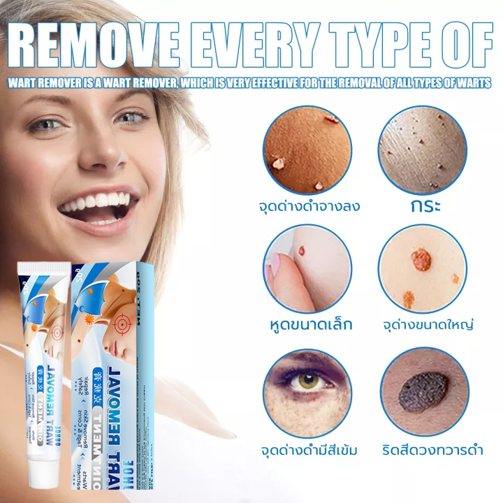 wart-remover-ointment20g