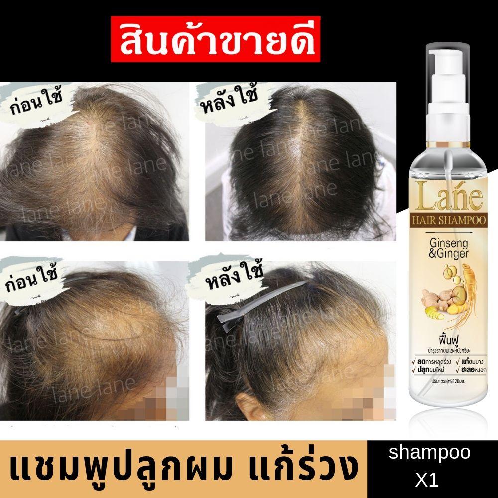 Lane hair growth shampoo แชมพูปลูกผม แชมพุสมุนไพร แชมพูขิง แชมพูเร่งผม
