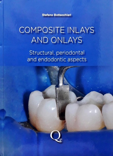 COMPOSITE INLAYS AND ONLAYS: STRUCTURAL, PERIODONTAL AND ENDODONTIC ASPECTS (HARDCOVER) Author: Stefano Bottacchiari Ed/Year: 1/2016 ISBN: 9788874920198