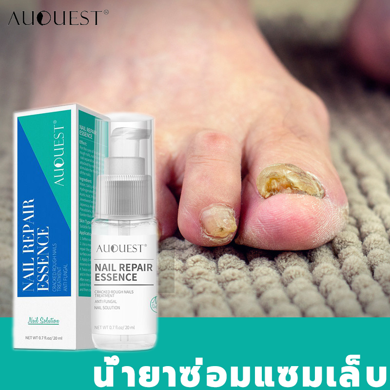 AuQuest บำรุงเล็บ เซรั่มบำรุงเล็บ ครีมบำรุงซ่อมแซมเล็บ เล็บเท้าคุณภาพสูง เอ็สเซ้นซ่อมแซมเล็บเสีย รักษารคเชื้อราที่เล็บ เล็บพัง เล็บขบ ต่อต้านเชื้อราเล็บมือเล็บเท้า ทำให้เล็บแข็งแร็ง บำรุงเล็บให้สวย สารสกัดจากพืชธรรมชาติ อ่อนโยนปลอดภัย AuQuest Nail Repair