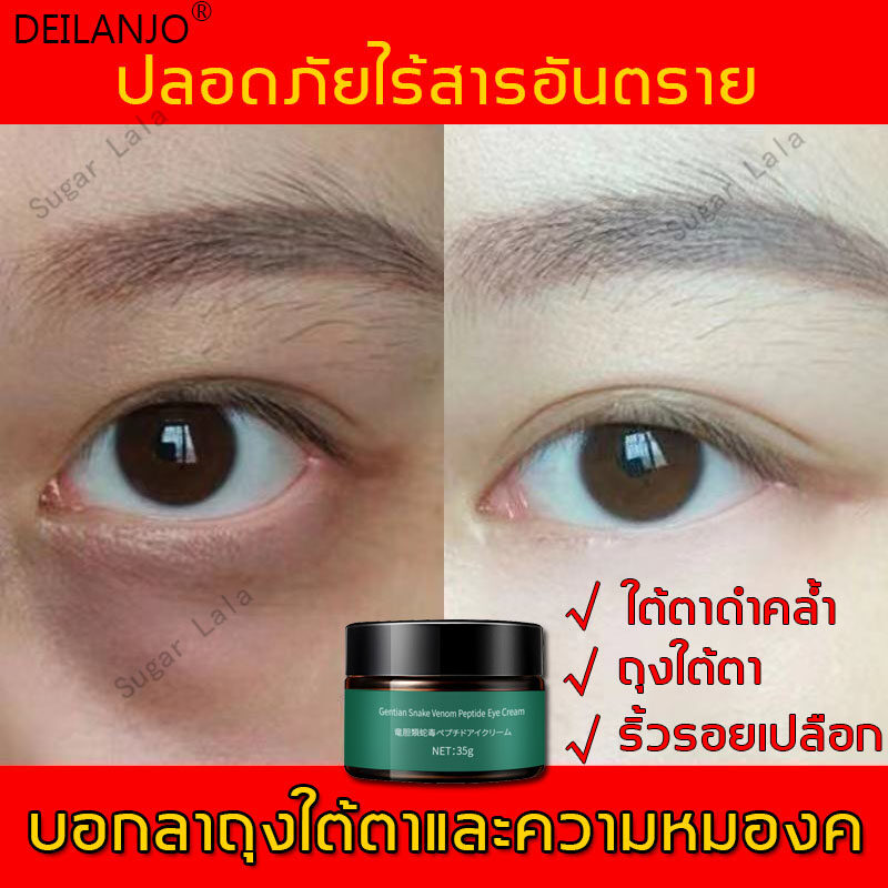 กำจัดถุงใต้ตาโดยไม่ต้องผ่าตัด Deilanjo ครีมบำรุงรอบดวงตา ครีมบำรุงรอบดวงตา  ลบถุงใต้ตา รอยคล้ำและริ้วรอย เปปไทด์พิษงู อายครีมบำรุงตา ครีมลดถุงใต้ตา ลดถุงใต้ตา  ให้ความชุ่มชื่น ขอบตาดำ ถุงใต้ตา ริ้วรอย รอยตีนกา ตาบวม าลดริ้วรอย อายครีม  ครีมบำรุงรอบดวงตา ...