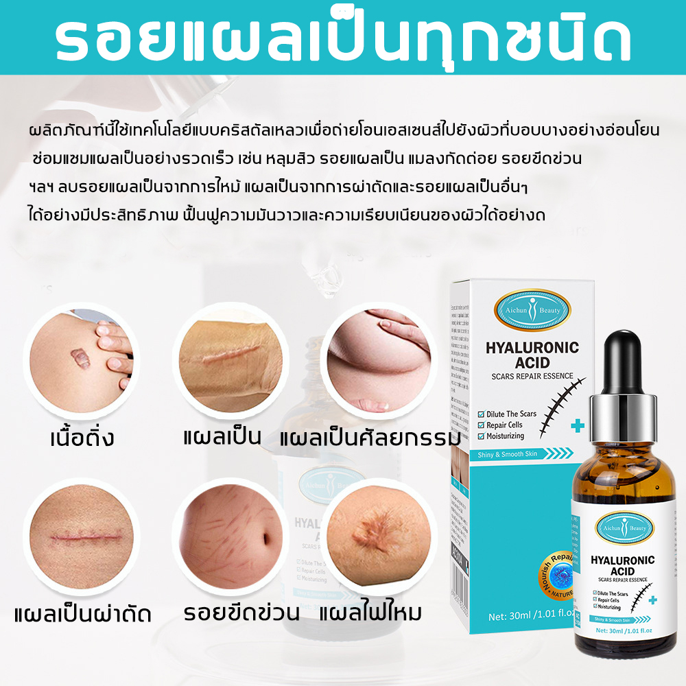 Aichun เซรั่มกรดไฮยาลูโรนิก ครีมลบแผลเป็น 30ml ครีมลบรอยแผลเป็น ปรับปรุงรอยแผลเป็น แผลเป็นถลอก