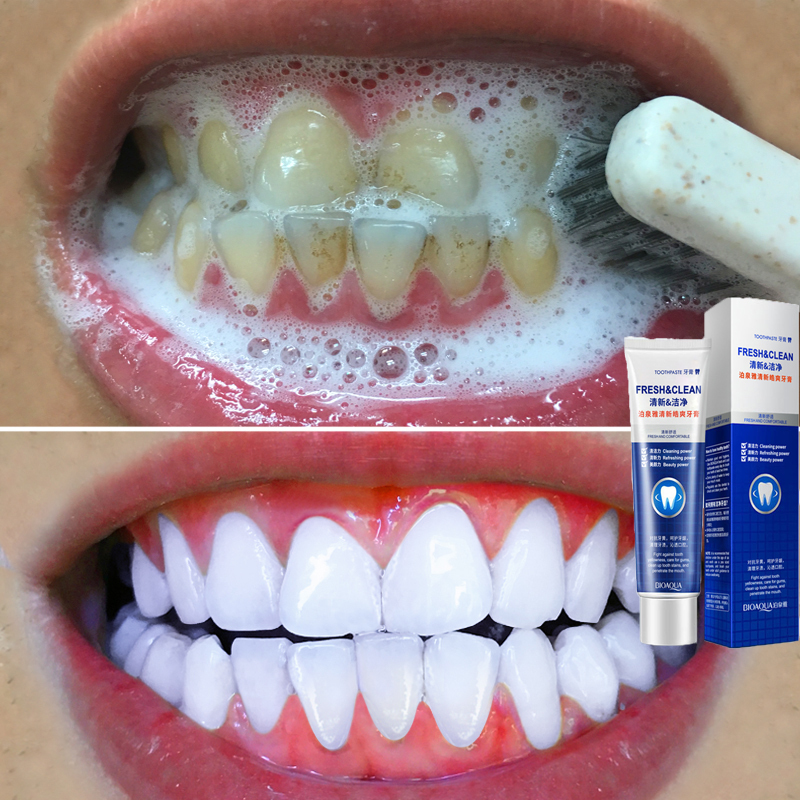 ยาสีฟันฟันขาว ยาสีฟันสมุนไพร ยาสีฟันฟอกขาว ยาสีฟัน ฟอกฟันขาว ฟันขาว ขจัดคราบหินปูน