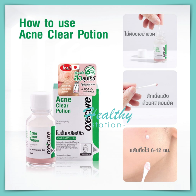 Oxe cure Acne Clear Potion 15 ml.