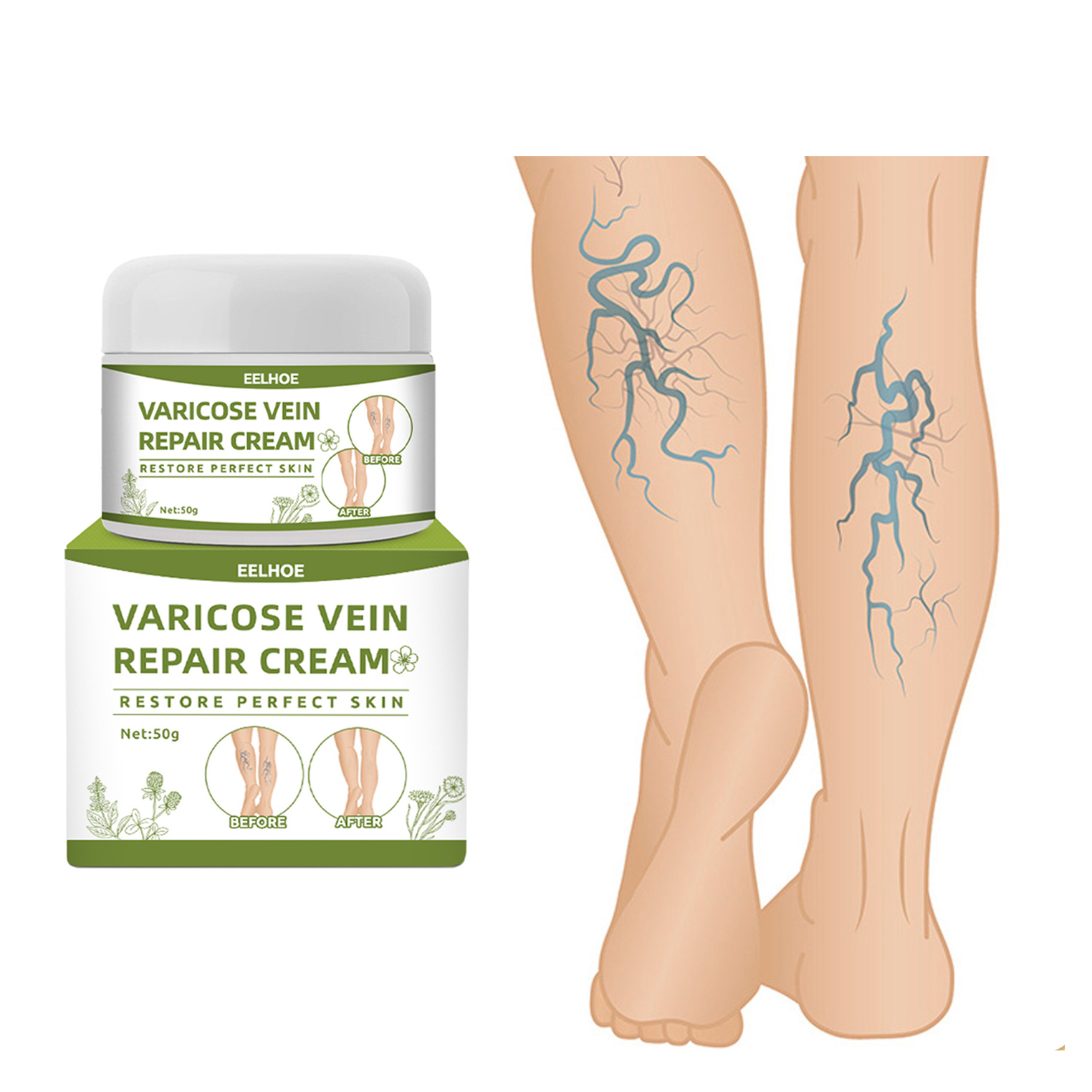 EELHOE Varicose Vein Cream Relief Phlebitis Angiitis Remedy Pain Cream For Spider Veins Edema