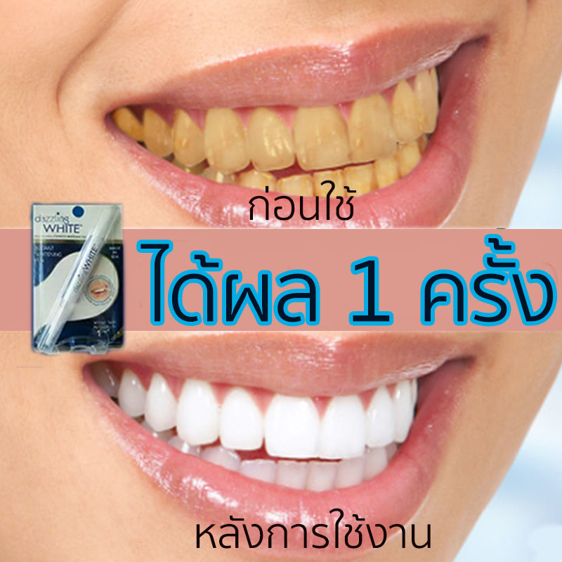 ยาฟอกฟันขาว  น้ำยาฟอกสีฟัน  ลดกลิ่นปาก คราบจุลินทรีย์ ปากเหม็น ฟันเหลือง คราบกาแฟ  คราบฟัน   ฟันผุTeeth whitening Plaque Clean Teeth  ทำความสะอาดช่องปาก  เซรั่มฟอกฟันขาว  ฟอกฟันขาว ใช้ได้ทุกฟัน  แก้ฟันดำ  โรคปริทันต์
