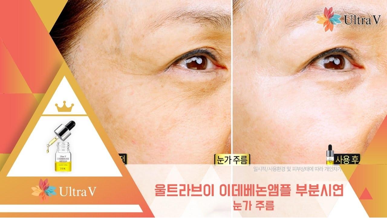 Ultra V Idebenone Ampoule 4 ขวด KOREA HISO ThaiPick