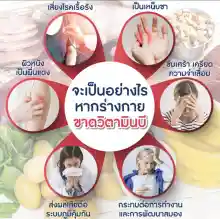 ภาพขนาดย่อของภาพหน้าปกสินค้า[ส่งฟรี]  วิตามินบีรวม เหน็บชา มือชา ปลายประสาทอักเสบ เท้าชา นิ้วล็อค Choline B [ของแท้] จากร้าน GiffONLZ บน Lazada ภาพที่ 3