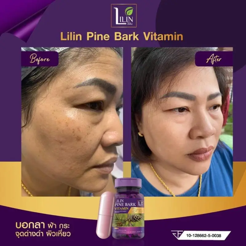 ภาพสินค้า1แถม1 LILIN Vitamin ลิลิน วิตามิน แก้ฝ้า จบปัญหา ฝ้า กระ จุดด่างดำ 1 กระปุก 30 แคปซูล แพคเก็จ จากร้าน Arunbeauti บน Lazada ภาพที่ 2