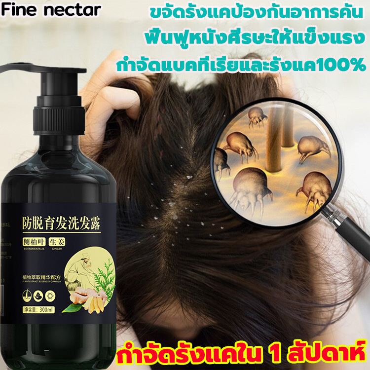 ZHENXIUแชมพูขจัดรังแค300gแชมพูขไร้รังแค ยาสระผมรังแค คุมมัน ดูแลเส้นผม
