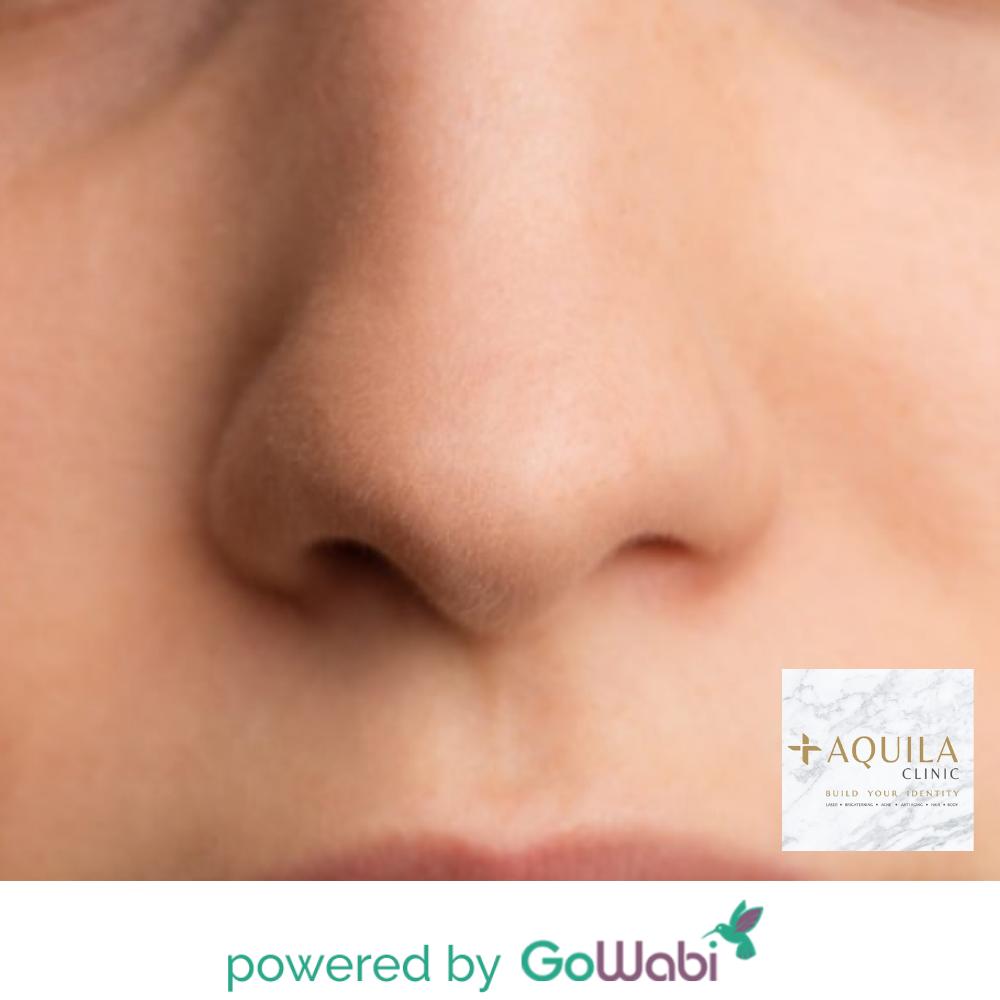 Aquila Clinic - Ultra Clean Nose - (2 times)