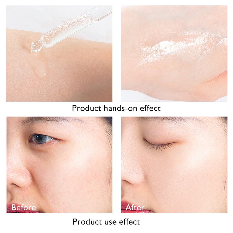 The Ordinary Lactic Acid 10 HA Acid Essence Gentle Exfoliating Closed