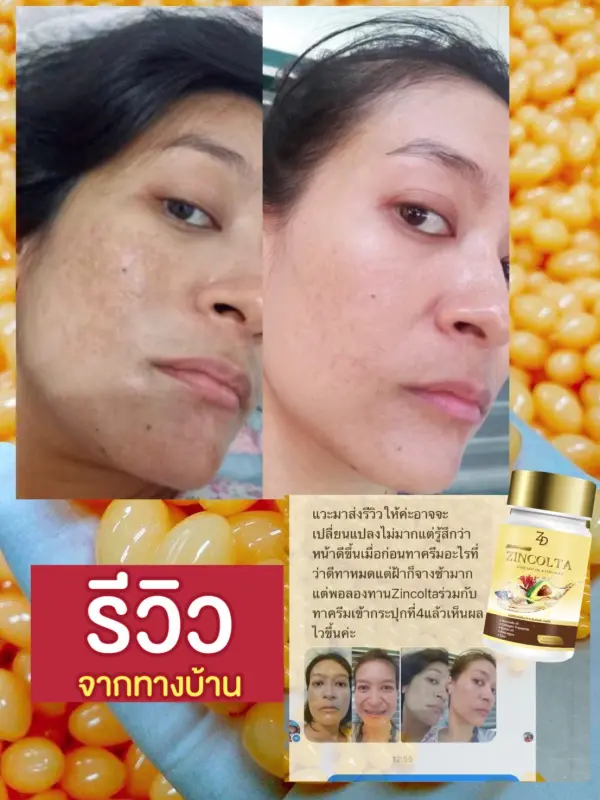 ภาพสินค้าซินคลอต้า Zincolta น้ำมันอโวคาโด้สกัดเย็นผสมคอลลาเจนเข้มข้น 2 แถม 1ส่งฟรีมีเก็บปลายทาง จากร้าน GREENHOUSE88 บน Lazada ภาพที่ 7