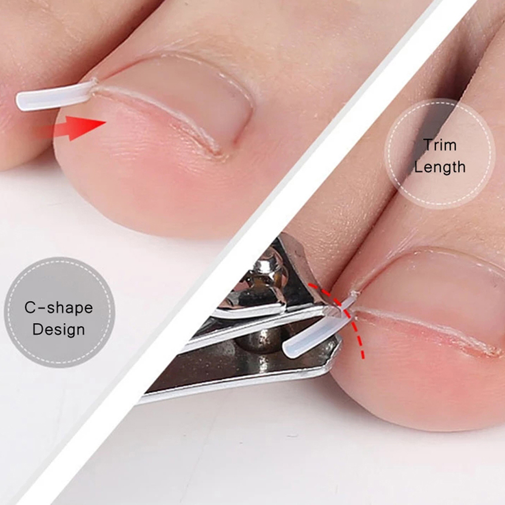 Miếng dán chỉnh hình móng chân mọc ngược WAF2125 - INTL
