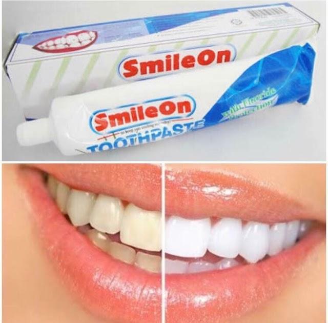 แนะนำ ZHULIAN Smile On Toothpaste ยาสีฟัน ซูเลียน สไมล์ออน ขนาด 250 กรัม (จำนวน 1 หลอด) Peggy