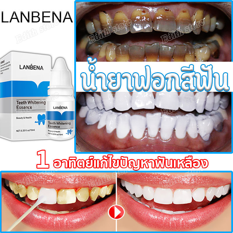 LANBENA เซรั่มฟอกฟันขาว  น้ำยาฟอกสีฟัน 1อาทิตย์แก้ไขปัญหาฟันเหลือง    ฟอกสีฟัน ยาสีฟันฟันขาว ทำความสะอาดช่องปาก ฟันเหลือง แก้ฟันดำ    ลดกลิ่นปาก ปากเหม็น คราบกาแฟ คราบฟัน โรคปริทันต์ ฟันเหลือง ฟันผุ 1อาทิตย์แก้ไขปัญหาฟันเหลือง  Teeth whitening