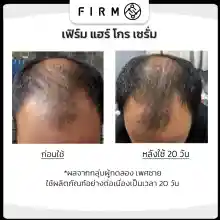 ภาพขนาดย่อของภาพหน้าปกสินค้า2 กล่อง FIRM Gro Serum (สูตรผู้ชาย) เซรั่มปลูกผม ลดผมร่วง ช่วยลดความมัน ลดการอักเสบ เส้นผมดกดำเงางาม ส่งฟรี จากร้าน FIRM Hair Serum บน Lazada ภาพที่ 5