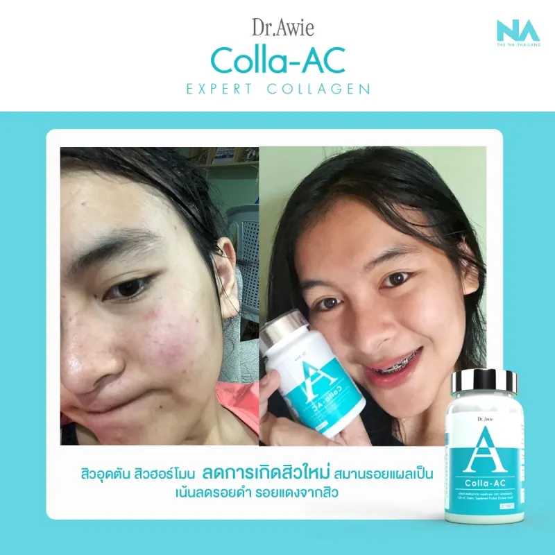 ภาพสินค้าDr.awie Colla AC 1 กระปุก 30 แคปซูล จากร้าน Dr.Awie x The Na  บน Lazada ภาพที่ 7