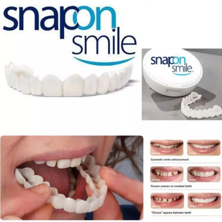 Snapon Smile Silicone Whitening Teeth Strips 2 Pcs Màu trắng nha khoa