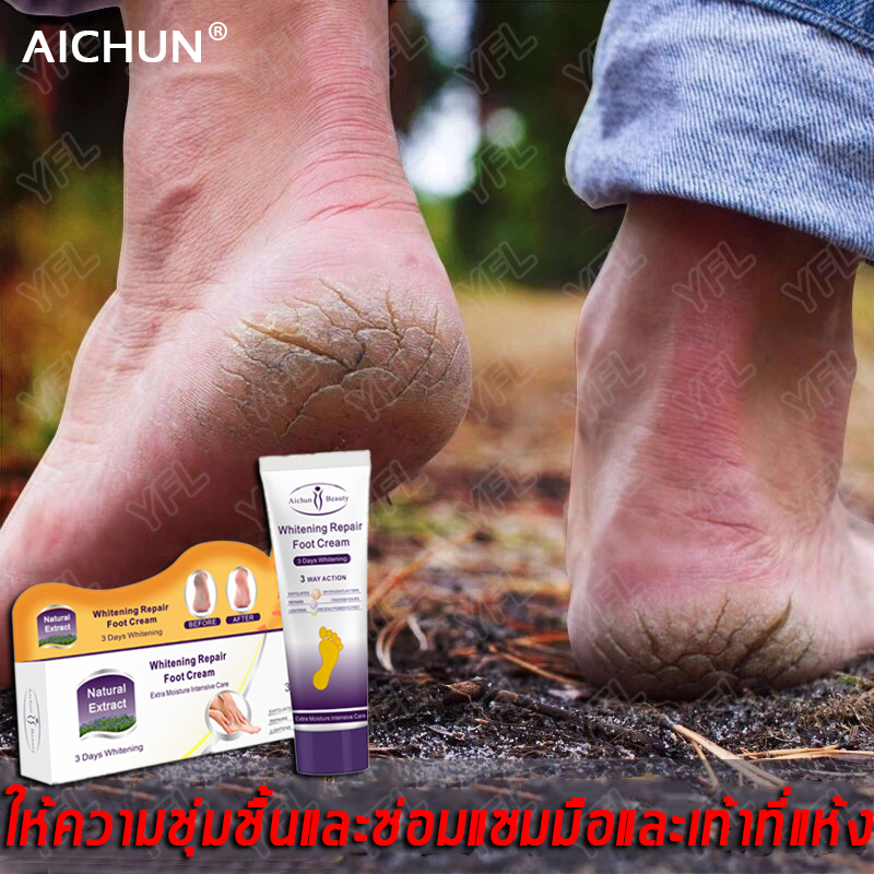 พร้อมส่ง！Aichun ครีมทาเท้า ครีมทาส้นแตก ครีมทาส้นเท้า Foot cream 100g ใช้สำหรับส้นเท้าแตก คันเท้า เท้าแห้ง เชื้อราเท้า ซ่อมแซมได้รวดเร็ว ดูดซึมง่าย ครีมทามือ ครีมบำรุงเท้า ครีมส้นเท้าแตก ครีมทาเท้าแตก ผลิตภัณฑ์ดูแลเท้า