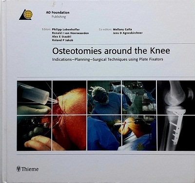 OSTEOTOMIES AROUND THE KNEE: INDICATION-PLANNING-SURGICAL TECHNIQUES USING PLATE FIXATORS (HARDCOVER) Author: Philipp Lobenhoffer Ed/Yr: 1/2008 ISBN:9783131475312