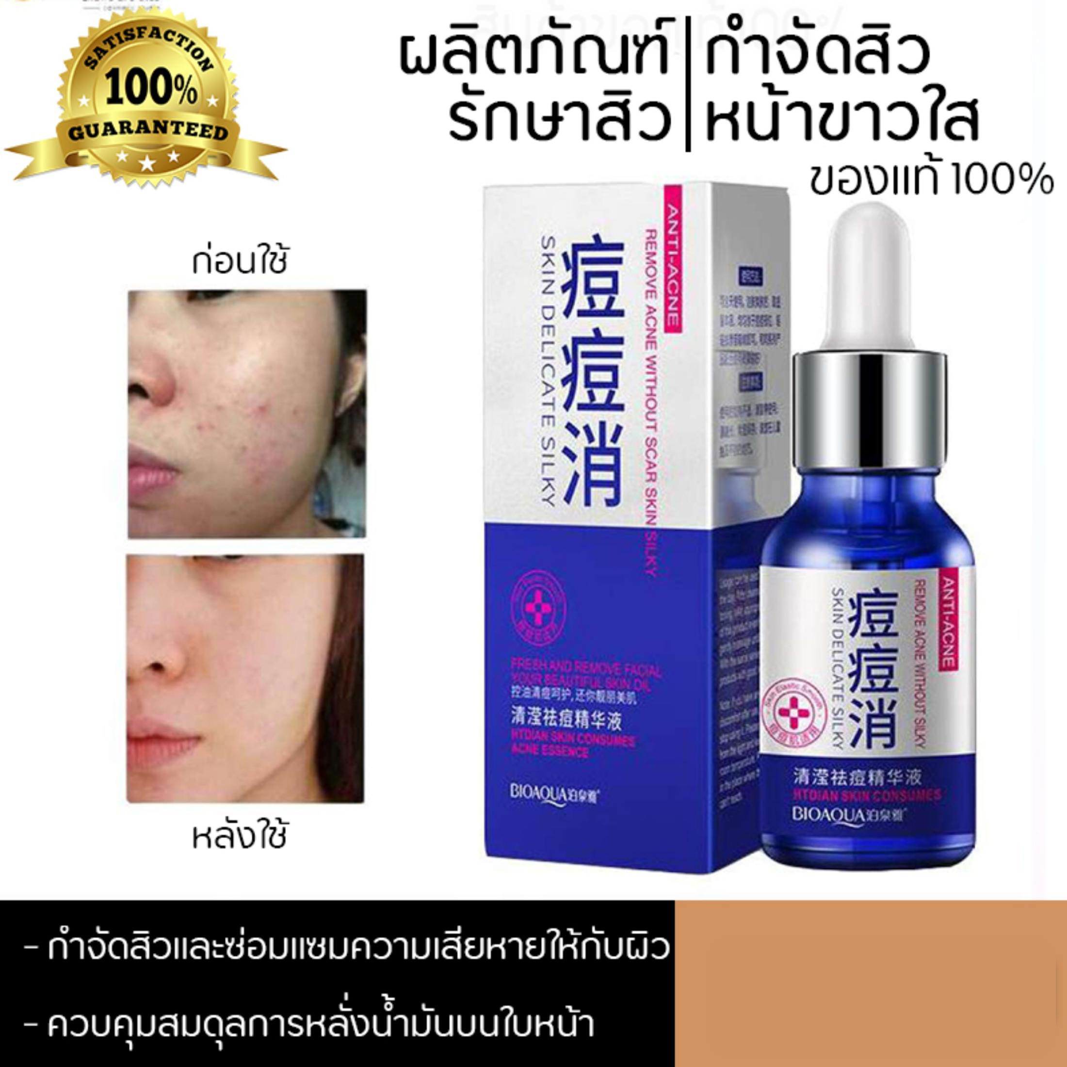 ครีมทาสิว Bioaqua AntiAcne Remove Acne Without Silky รอยสิวแลดูจางลง