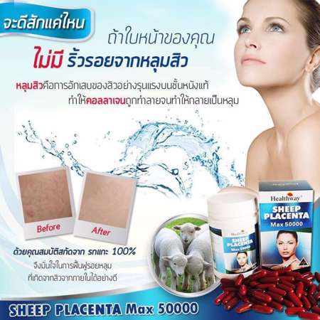 Healthway Sheep Placenta Max 50000 mg รกแกะผิวเด็ก 100เม็ด (1กระปุก)