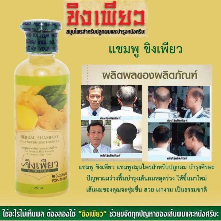Keing Pure Shampoo แชมพู ขิงเพียว แชมพูสมุนไพรสำหรับปลูกผม บำรุงหนังศีรษะ ปัญหาผมร่วง ฟื้นบำรุงเส้นผมหลุดร่วง ให้ขึ้นมาใหม่ เส้นผมของคุณจะชุ่มชื่น สวย เงางาม เป็นธรรมชาติ 1 ขวด 250 ดีไหม