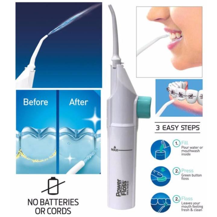 โปรโมชั่น Power Floss อุปกรณ์ดูแลช่องปาก อุปกรณ์ทำความสะอาดฟัน เครื่องพ่นน้ำแทนไหมขัดฟันขจัดเศษอาหารตามซอกฟันให้สะอาดหมดจด เหมาะสำหรับเหล็กดัดฟัน/ใช้แทนไหมขัดฟัน pantip