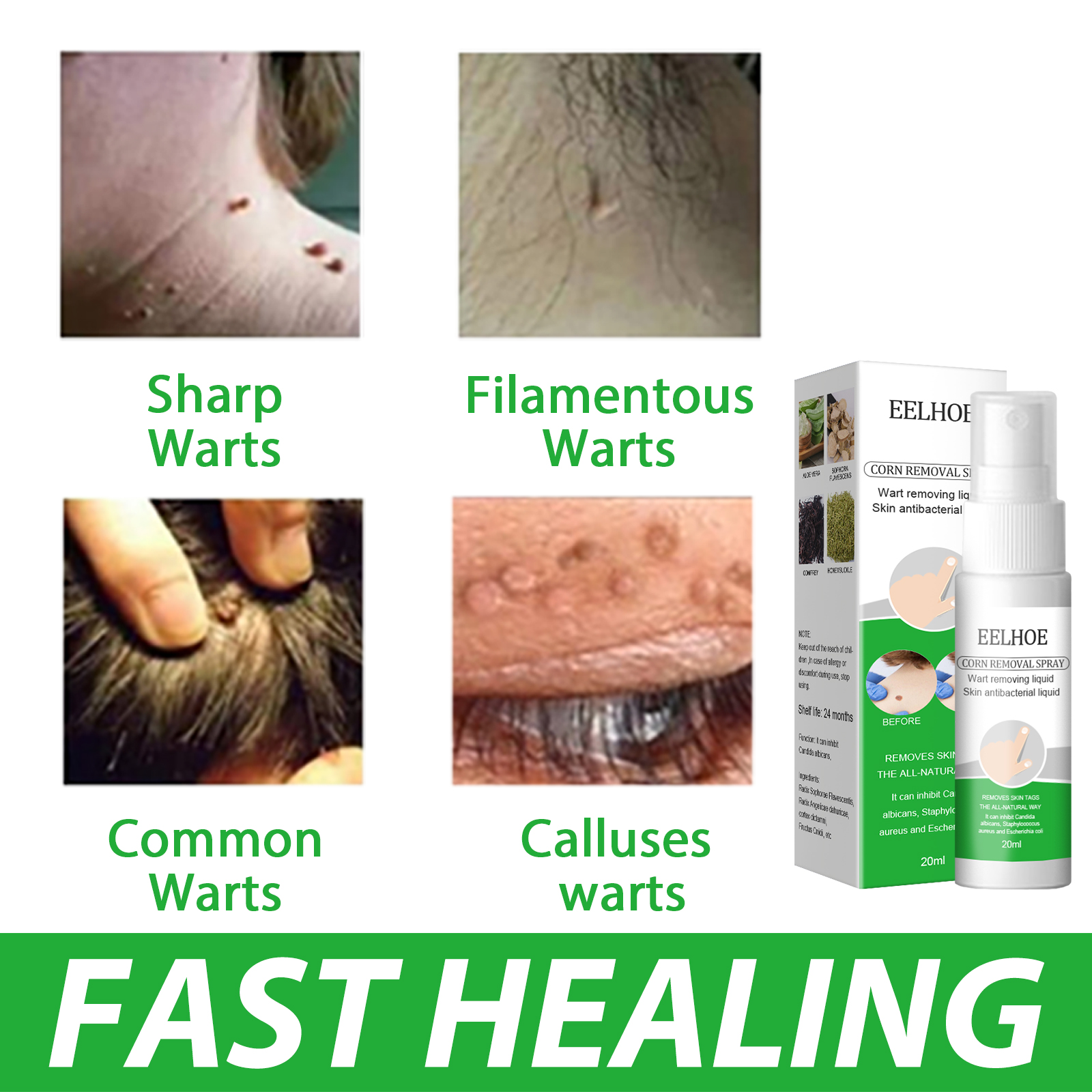 Eelhoe Corn Removal Spray Wart Remover Ointment Mole Remover Wart
