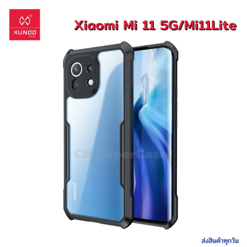 XUNDD เคส Xiaomi Mi11/Mi 11 5G/Mi 11 Lite/Mi11Lite ของแท้% เคสกันเลนส์กล้อง ขอบนิ่ม-หลังแข็ง-หลังใส [จัดส่งด่วน]