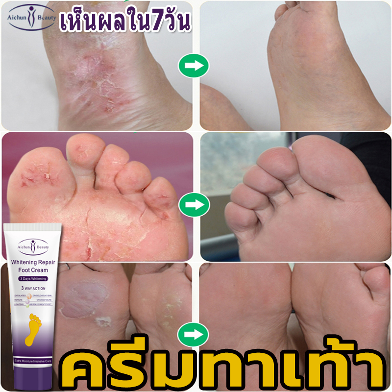 ดูแลเท้า ดูแลมือ Aichun ครีมทาเท้าแตก100g Foot cream ครีมทาเท้า ครีมทาส้นแตก เพิ่มความชุ่มชื้น ครีมทาเท้าขาว บำรุงโดยโภชนาการ ครีมบำรุงเท้า กระจ่างใส กักเก็บน้ำ ครีมทามือ FOOT CRACKED HEELS CREAM