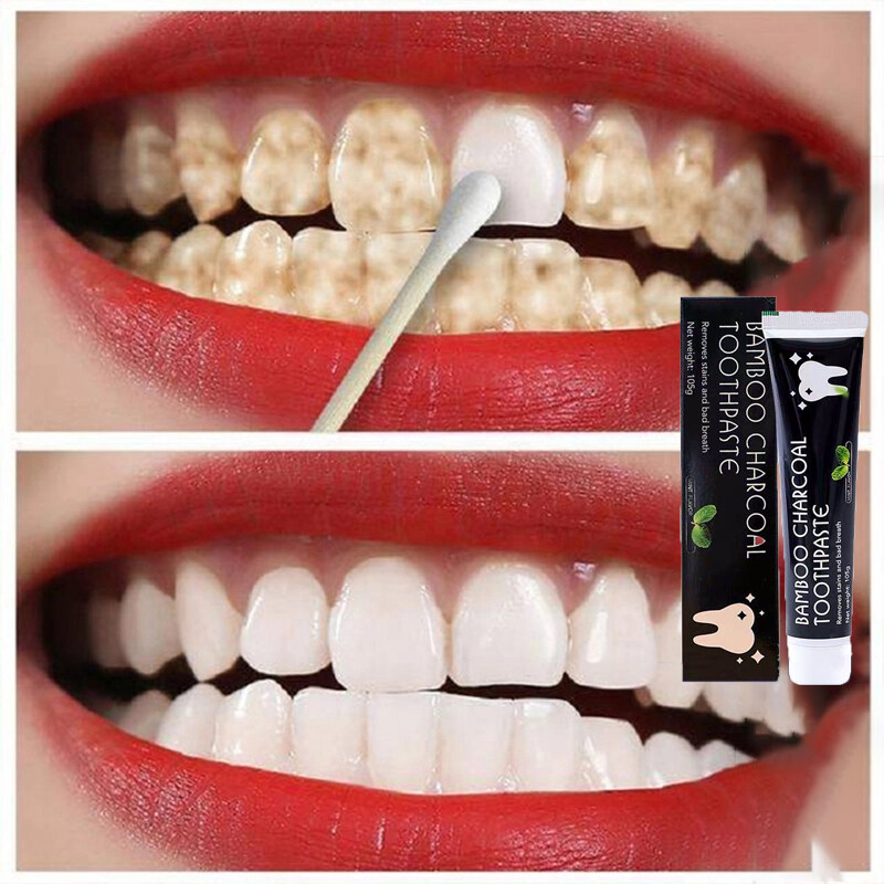 ยาสีฟันขจัดปูน ฟอกฟันขาว ยาสีฟันฟันขาว ยาสีฟันฟอกขาว ยาสีฟัน ขจัดกลิ่นปาก ฟอกฟันขาว ฟอกสีฟัน บำรุงเหงือก Teeth Whitening