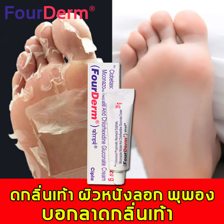 FourDerm ครีมลดกลิ่นเท้า 20g สเปรย์ฉีดเท้า รักษากลิ่นเท้า เท้าเน่า ลอก คันเท้า ดับกลิ่นทุกชนิด กำจัดเชื้อราที่เท้าได้ 99%(ครีมติดเชื้อรา ระงับกลิ่นเท้า ยาดับกลิ่นเท้า แก้เท้าเหม็น ครีมส้นเท้าแตก ยาทาเท้าเหม็น)