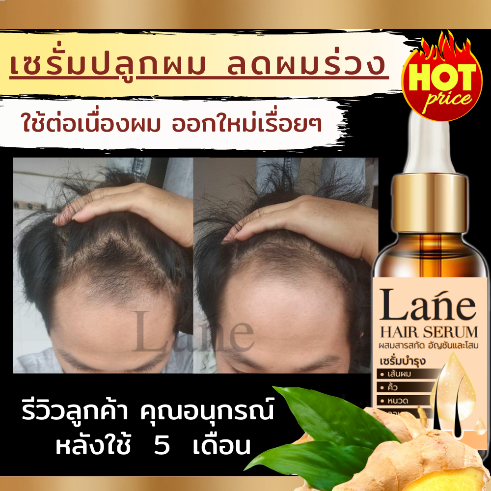 Lane น้ำยาปลูกผม ปลูกผมเร่งด่วน เซรั่มปลูกผม ยาปลูกผม   ปลูกหนวด ปลูกผม ปลูกคิ้ว Hair Growth ผมบาง หัวล้าน ลดหงอกX1 ขวด