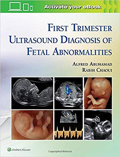 FIRST TRIMESTER ULTRASOUND DIAGNOSIS OF FETAL ABNORMLITIES (HARDCOVER) Author:Alfred Abuhamad Ed/Year:1/2018 ISBN: 9781451193725