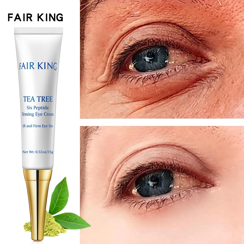 FAIR KING Anti Wrinkle Eye Cream Removes Dark Circles Eye Bags