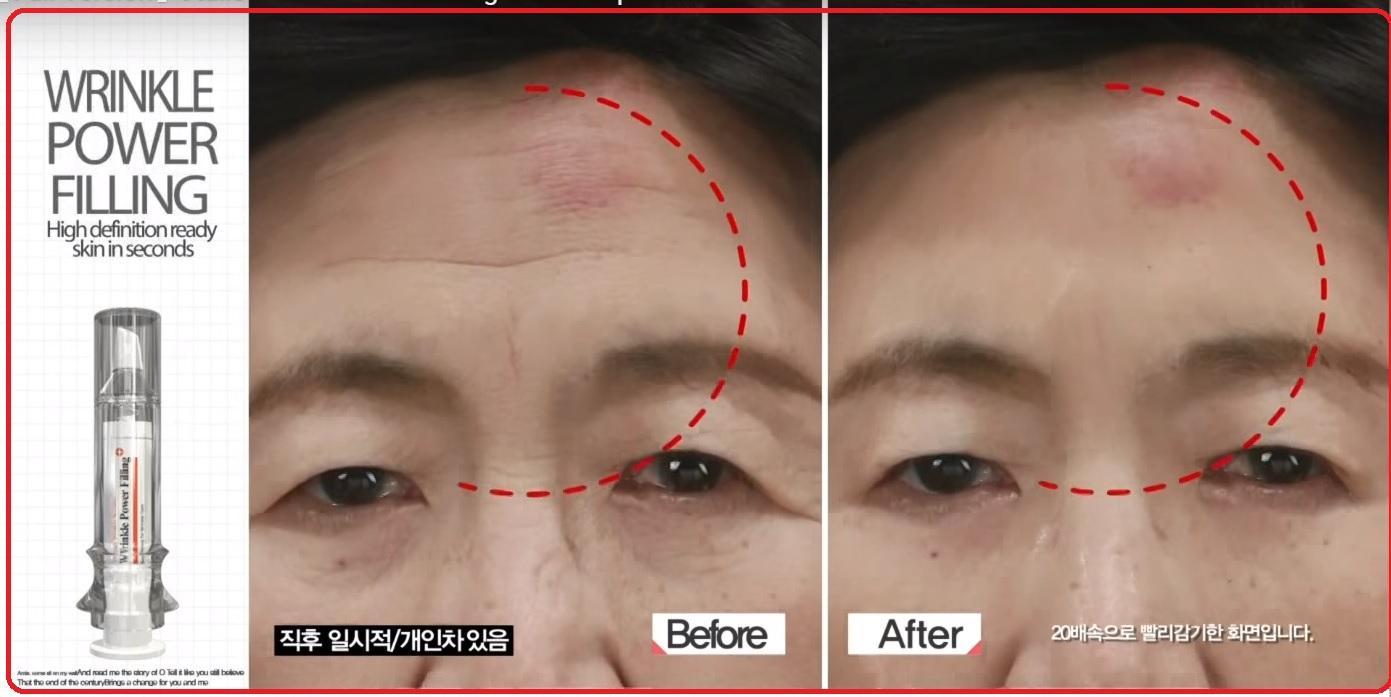 Wrinkle Power Filling Danger